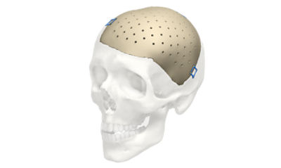Cranial iD | Stryker